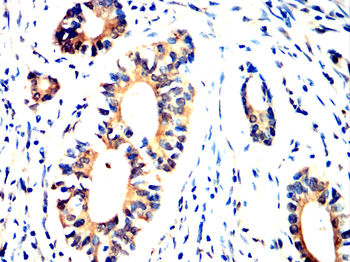 RET Antibody