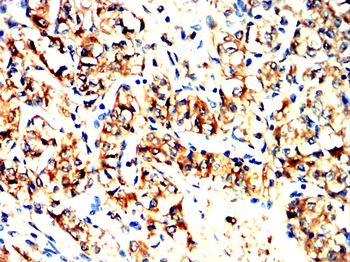 RET Antibody