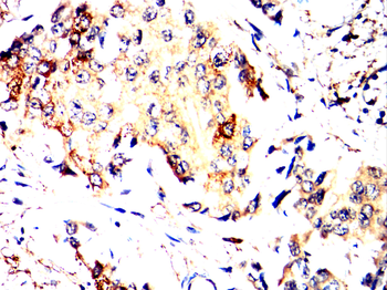 CDH1 Antibody