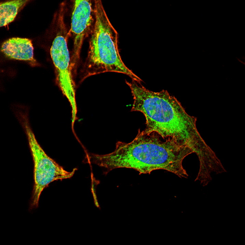 MMP1 Antibody
