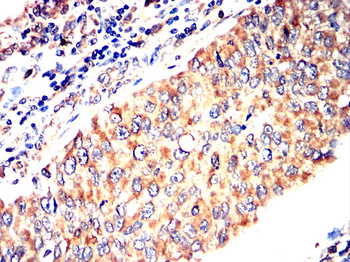MAP3K7 Antibody