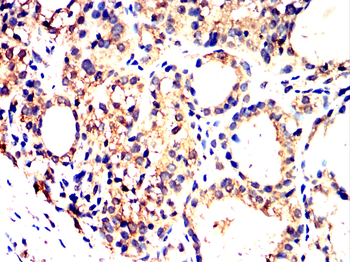 MAP3K7 Antibody