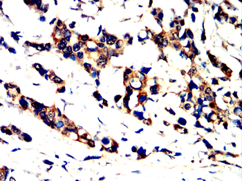 AP2M1 Antibody