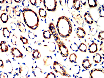 AP2M1 Antibody