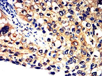 AP2M1 Antibody