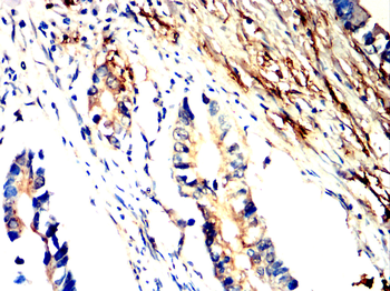 AP2M1 Antibody