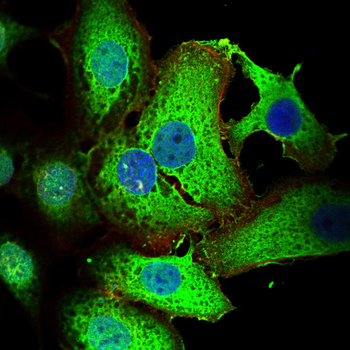 CNP Antibody