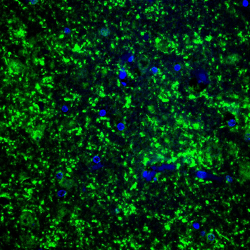 CNP Antibody