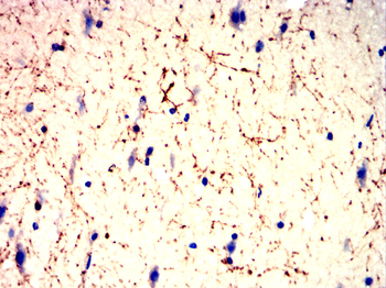 CNP Antibody