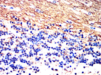 CNP Antibody