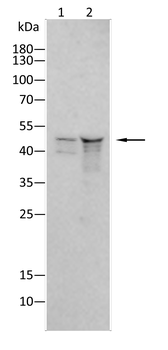 CNP Antibody