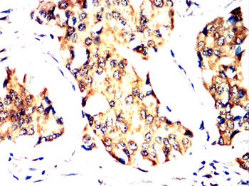 ABCC2 Antibody