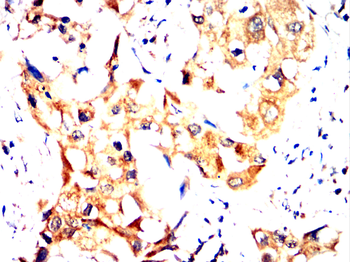 ABCC2 Antibody