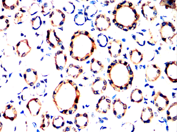 ABCC2 Antibody