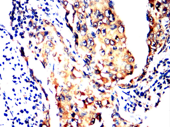 ABCC2 Antibody