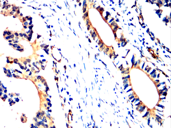 ABCC2 Antibody
