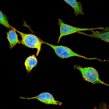TTR Antibody