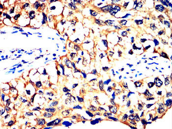 TTR Antibody