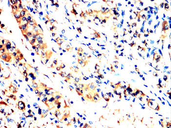 TTR Antibody