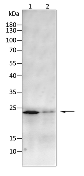 TTR Antibody