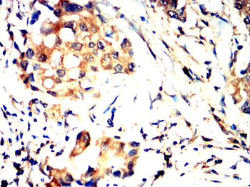 ACLY Antibody
