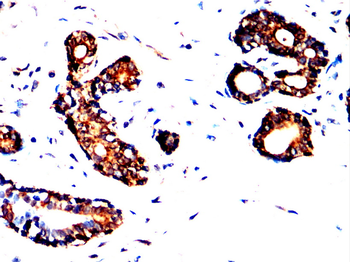HTR2C Antibody