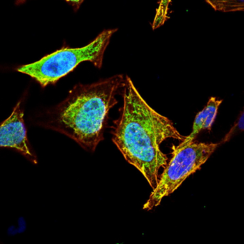 PRKCE Antibody