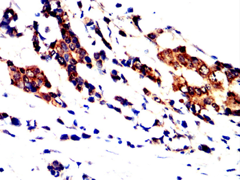 PRKCE Antibody
