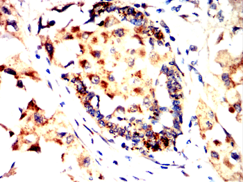 PRKCE Antibody