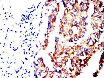 PRKCE Antibody