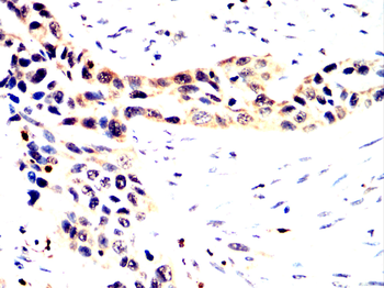 PRKCE Antibody