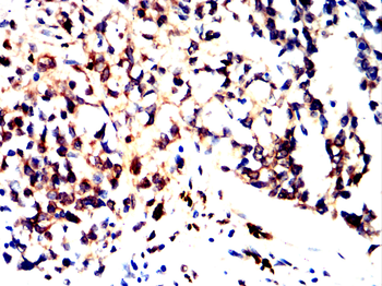 PRKCE Antibody