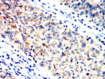 PRKCE Antibody
