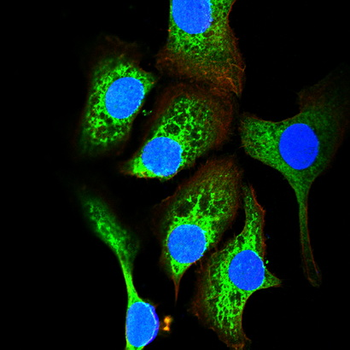 S100A6 Antibody