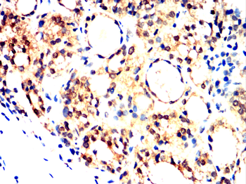 ITGA6 Antibody