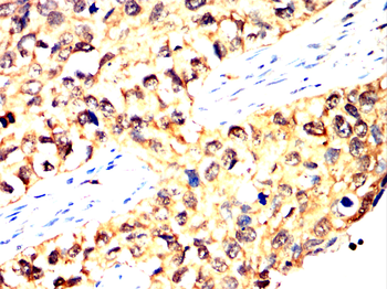 PARK7 Antibody