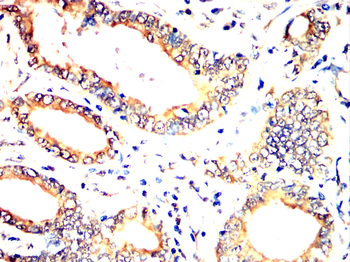 PARK7 Antibody