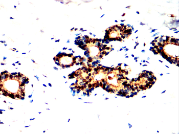 BIRC5 Antibody