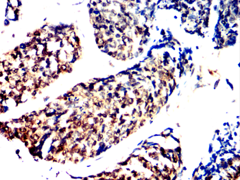BIRC5 Antibody