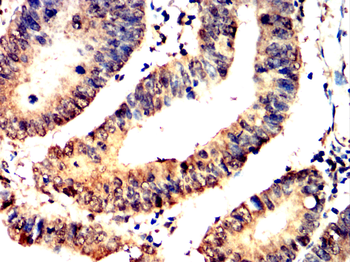 BIRC5 Antibody