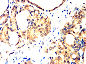 BIRC5 Antibody