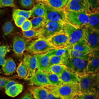 ATF5 Antibody