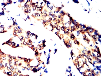 ATF5 Antibody