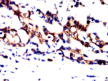 ATF5 Antibody