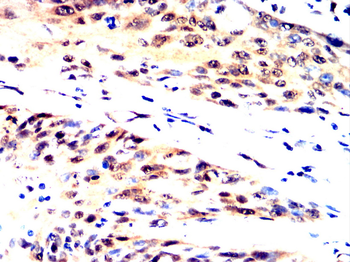 ATF5 Antibody