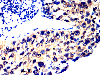 ATF5 Antibody