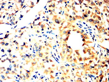 ATF5 Antibody