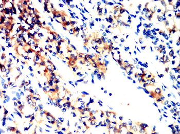 ATF5 Antibody