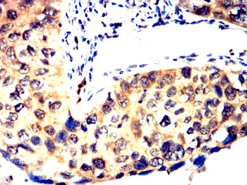 NR4A1 Antibody
