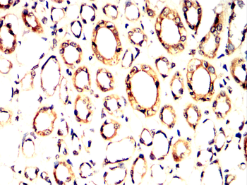 HK1 Antibody